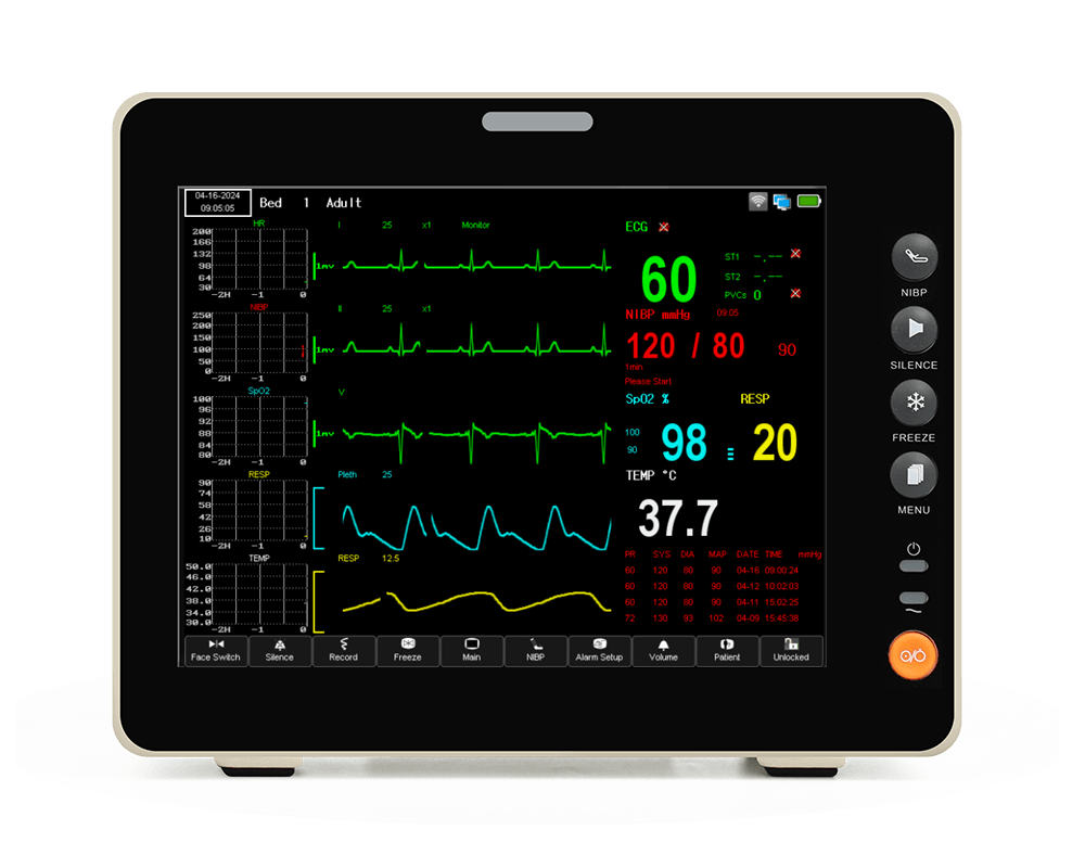 8-Inch Touchscreen+EtCO2 Portable Patient Monitor- Tracks